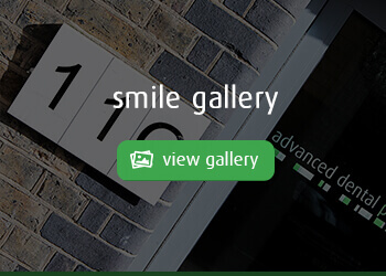 smile gallery